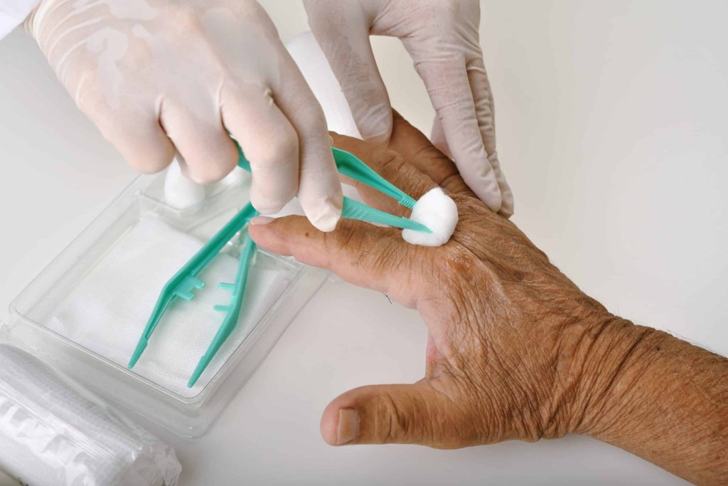 A healthcare worker with gloved hands uses forceps and a cotton ball to clean or treat a wound on an elderly person's hand, with medical supplies visible nearby on a white surface.